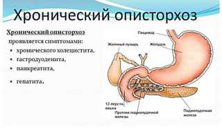 Лечение желчного пузыря после описторхоза