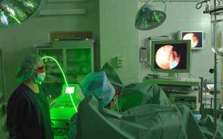 Клиники по урологии аденома простаты