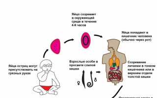 Диагностика аскаридоза и энтеробиоза