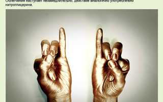 Большой медицинский словарь — значение слова Симптом Указательного Пальца