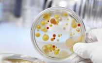 Что такое стрептококковая инфекция в урологии