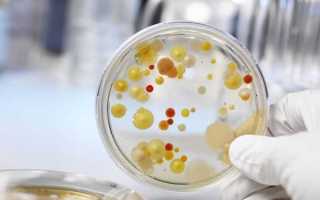 Что такое стрептококковая инфекция в урологии