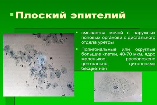 Плоский эпителий