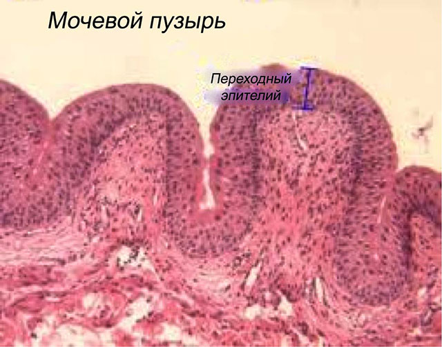 Эпителий плоский в моче - что это значит?