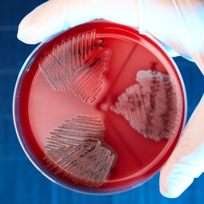 Бета-гемолитические стрептококки